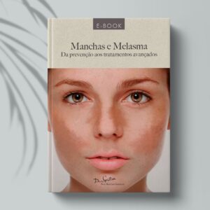 E-book Manchas e Melasma - Da prevenção aos tratamentos avançados