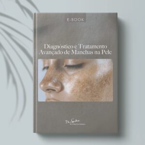 Ebook - Diagnóstico e Tratamento Avançado em Manchas na Pele