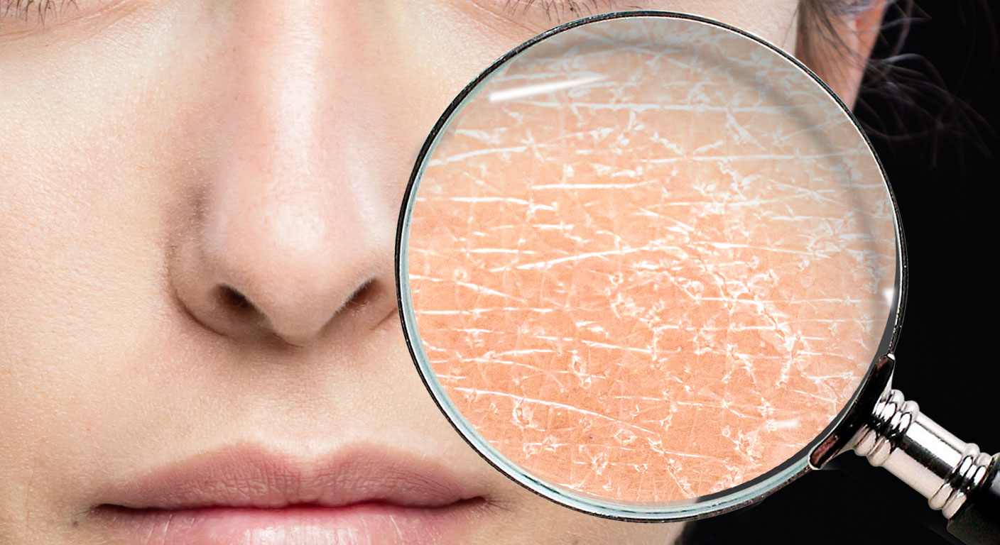 Desidratação cutânea: a diferença entre pele seca e pele desidratada