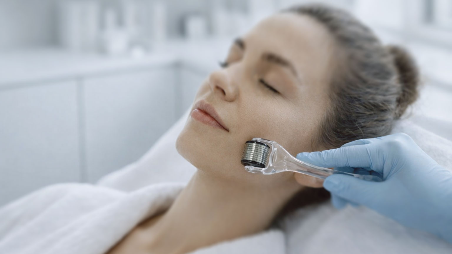 Microagulhamento em Manchas: Quando Ajuda e Quando Pode Prejudicar